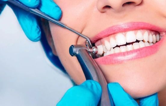 Professional teeth polishing treatment at Scanlab Diagnostics